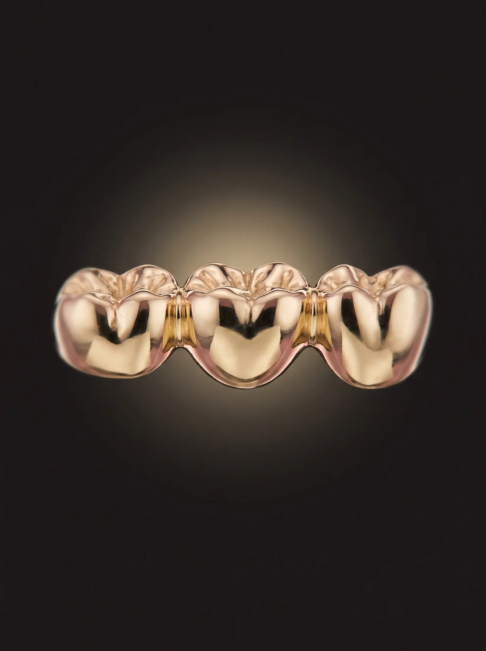 Crowns, bridges and restorative care
